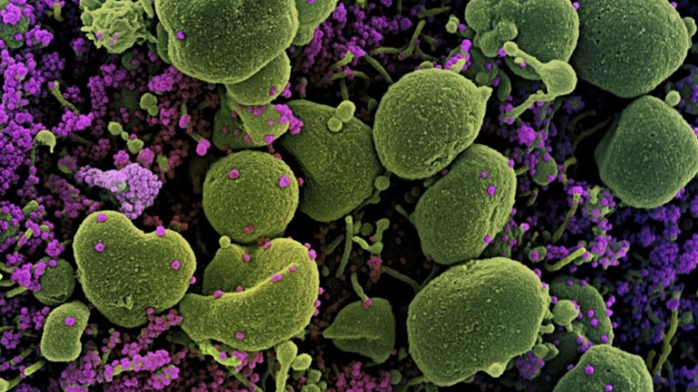 اخبار-جهان-پس-از-کرونای-برزیلی-اکنون-کرونای-آفریقای-جنوبی-هم-از-واکسن-و-پادتن-عبور-می-کند