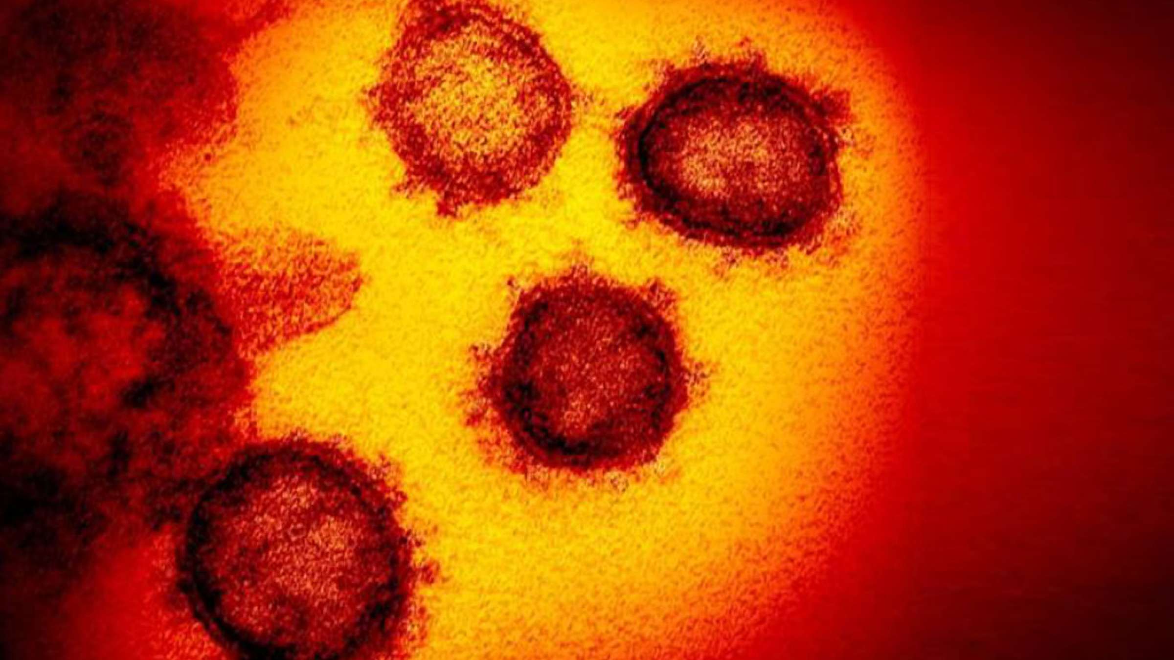 اخبار-کانادا-بیمه-لغو-پرواز-بعلت-کرونا-لغو-شد