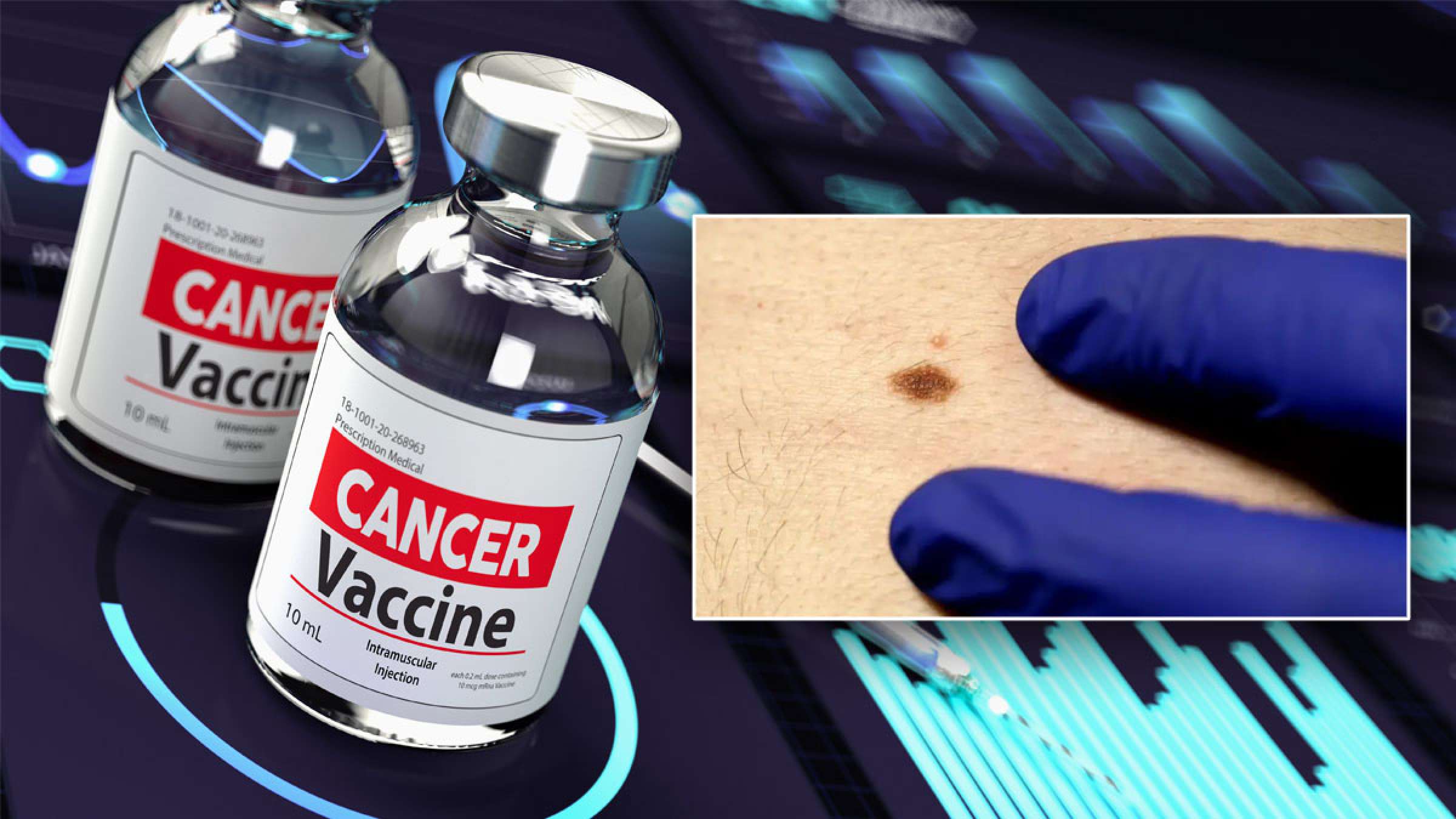 واکسن-جدید-آر-ان-ای-ملانوما-بازگشت-سرطان-پوست-مرگ-ناشی-نصف