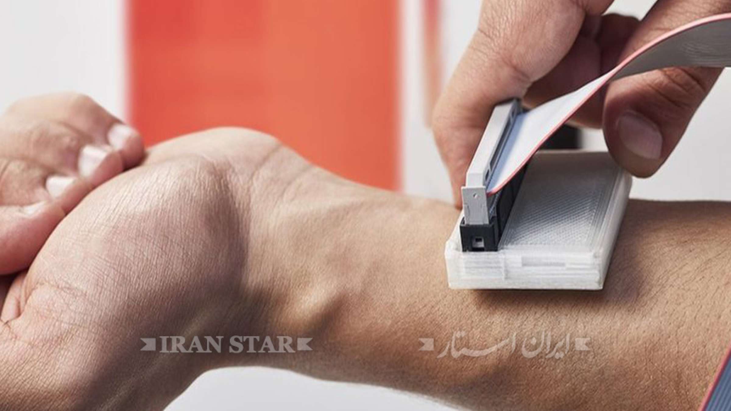 dastgahe-tashkhose-saratane-poost dastgahe-tashkhose-saratane-poost