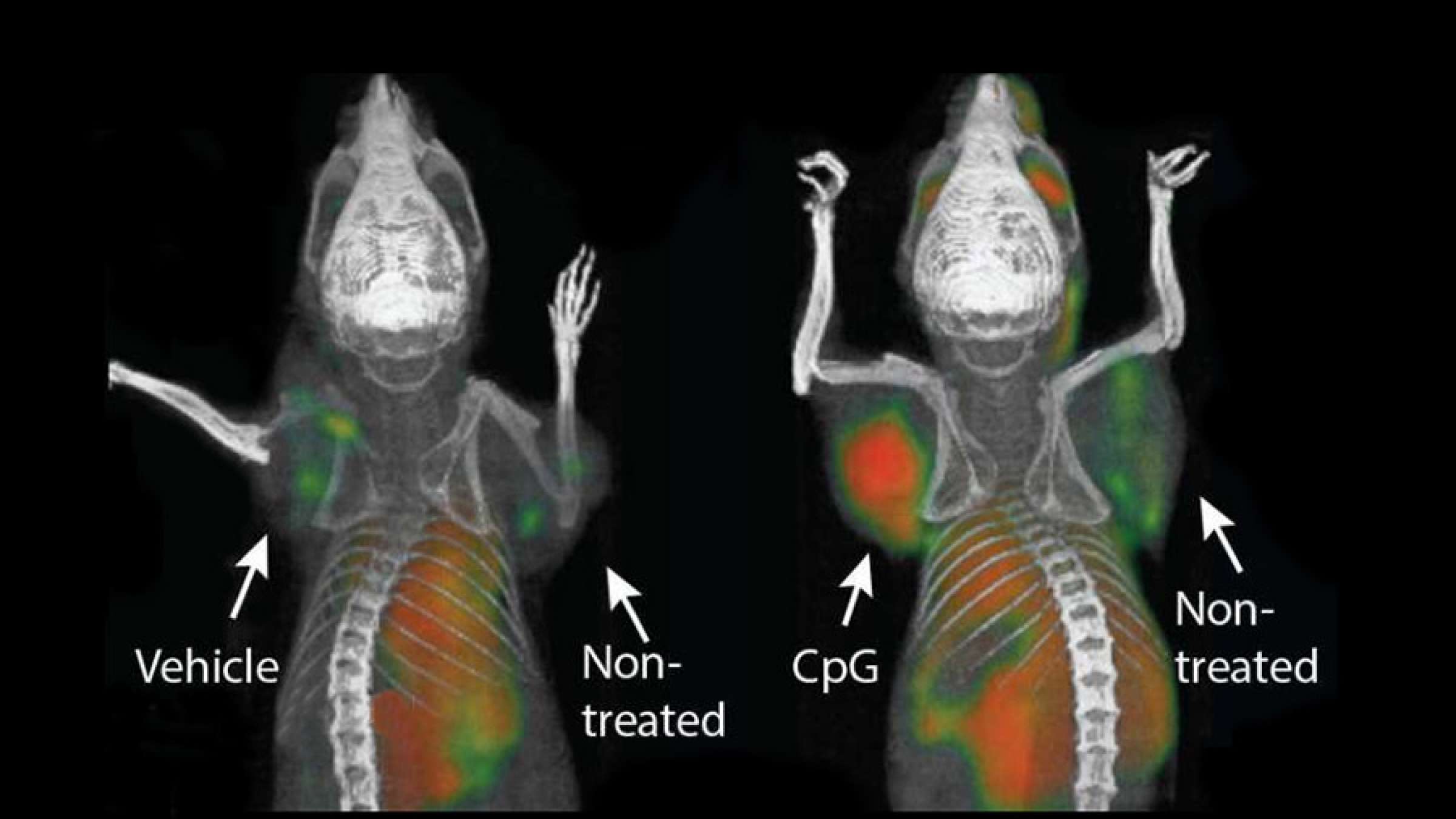 health-vaksan-saratan