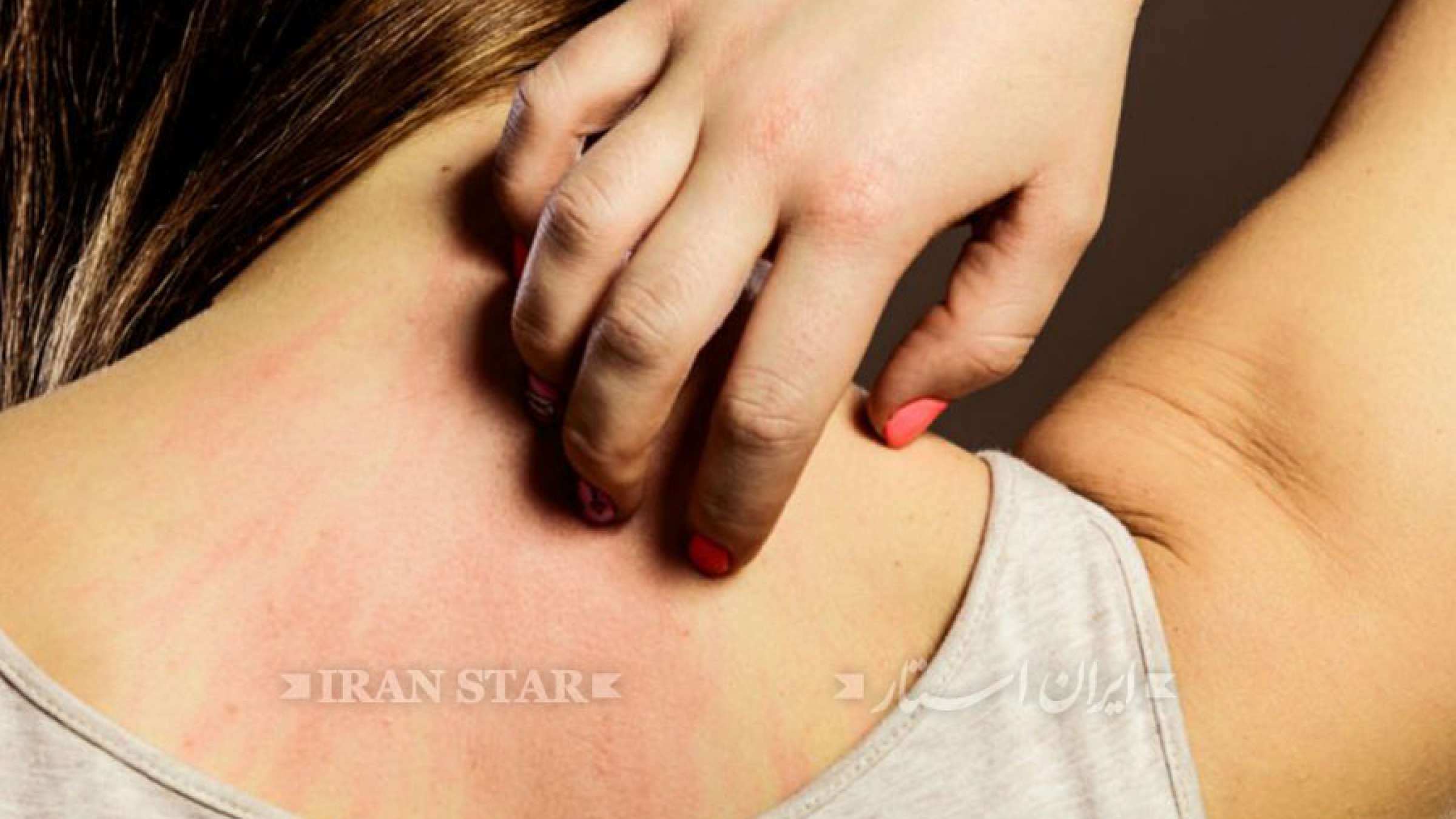 khareshe-tanetan-azkhoshki khareshe-tanetan-azkhoshki