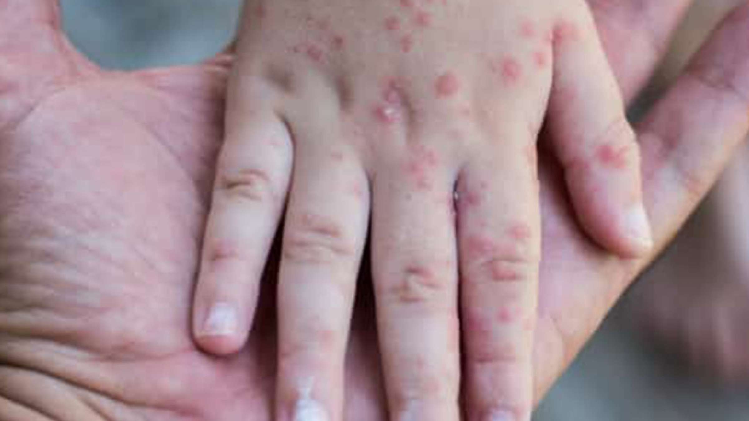 news-sorkhak-toronto