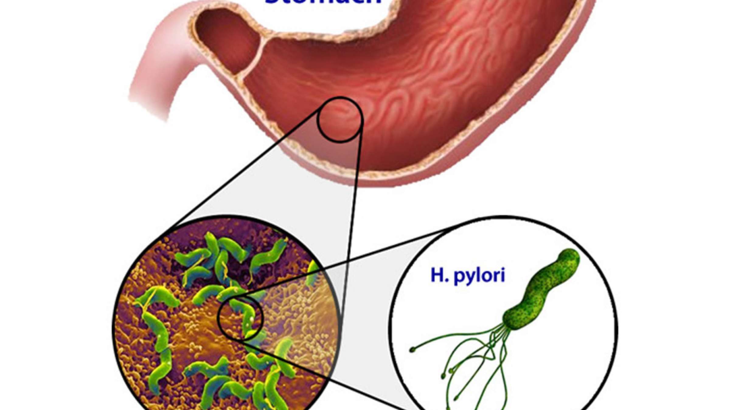 rahimian-insurance-pylori