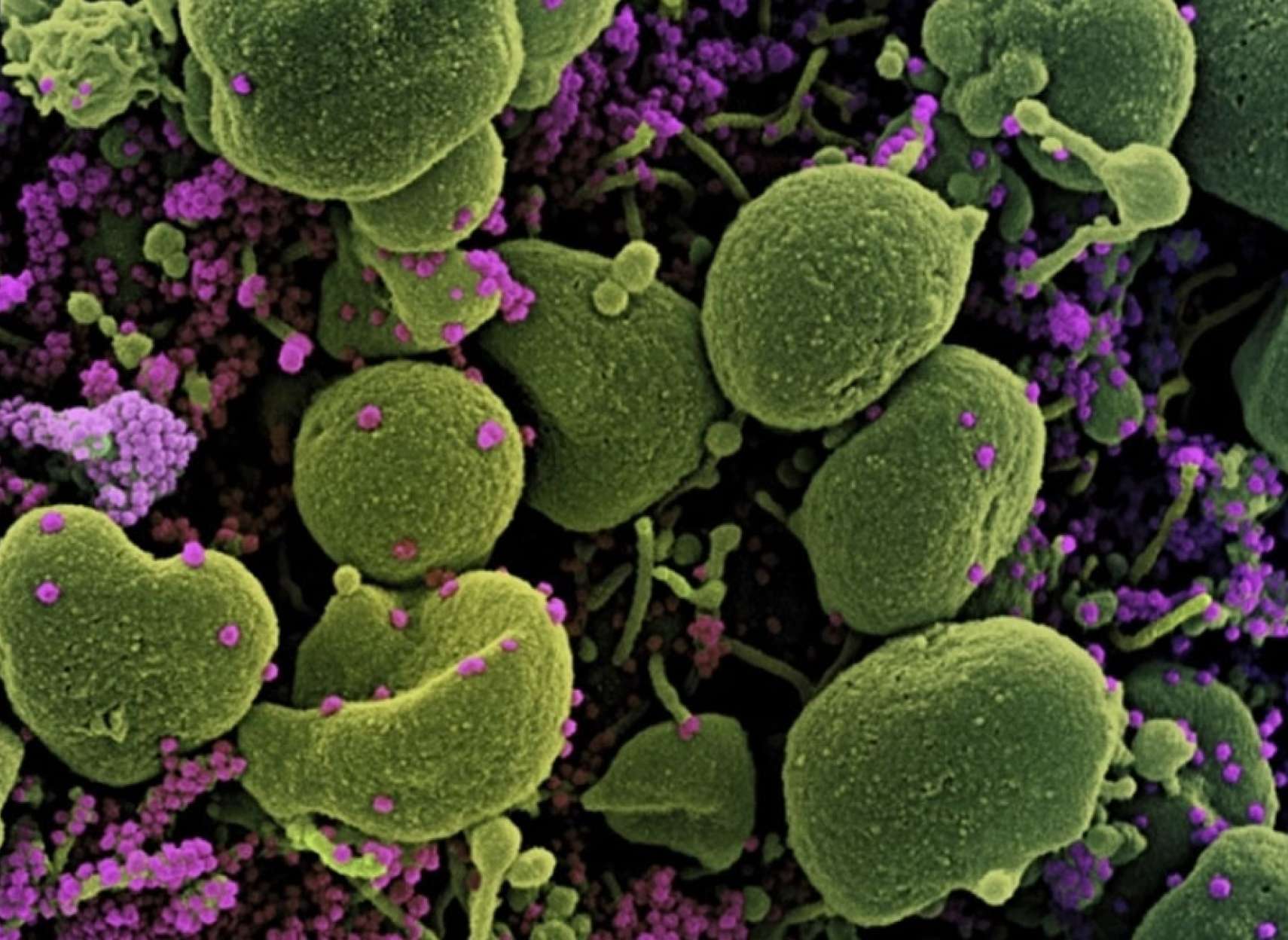 اخبار-جهان-پس-از-کرونای-برزیلی-اکنون-کرونای-آفریقای-جنوبی-هم-از-واکسن-و-پادتن-عبور-می-کند