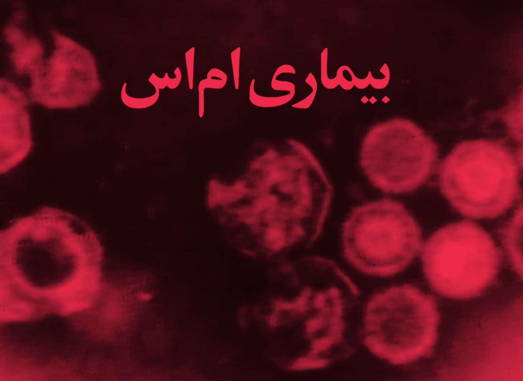 خبر-علمی-محققان-هاروارد-عامل-بیماری-ام-اس-یک-ویروس-است