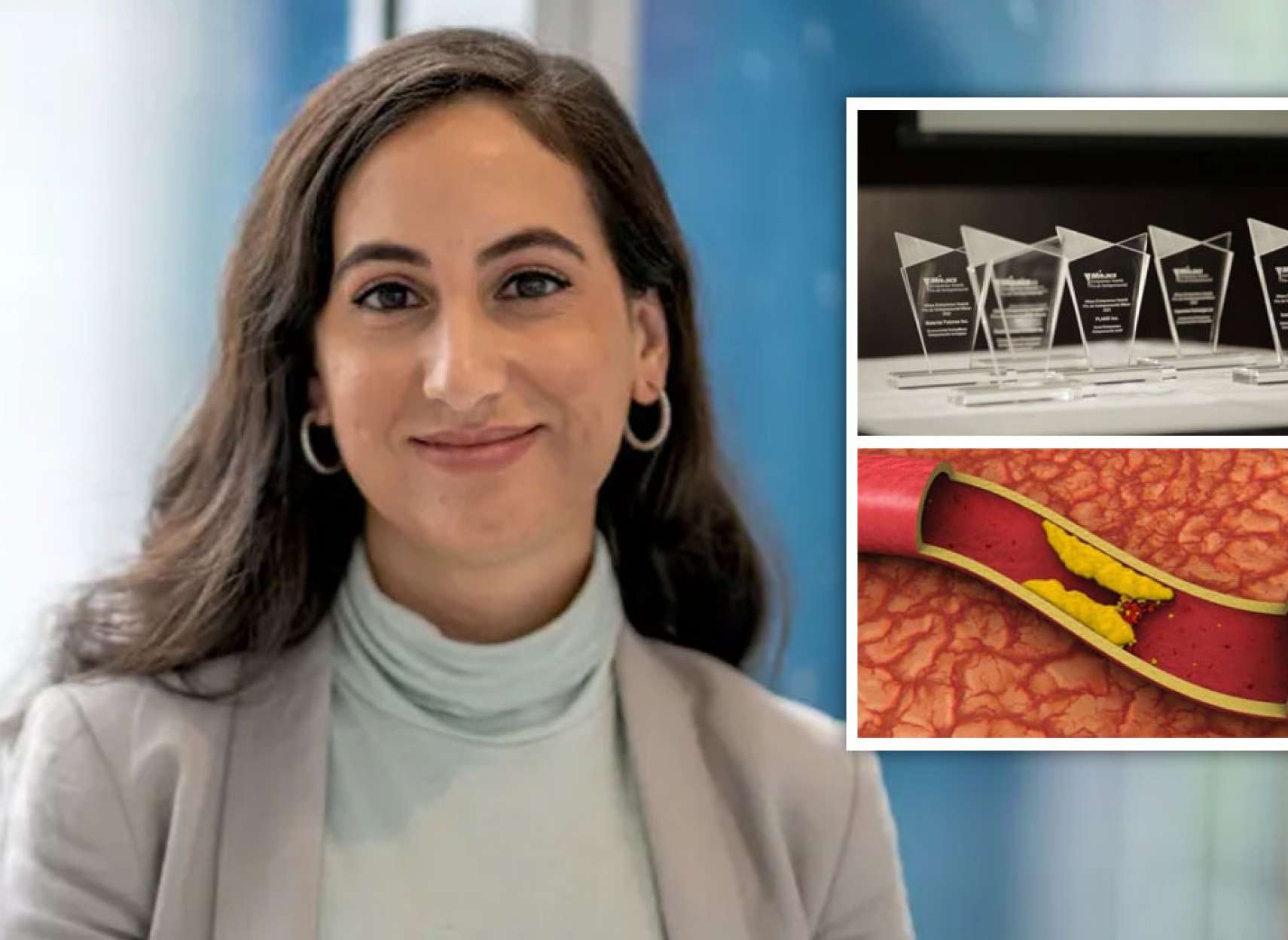 علمی-برنامه-هوش-مصنوعی-سکته-پیش-بینی-پیشگیری-بالاترین-جایزه-اجتماعی-بیزینسی-کانادا